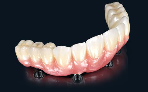 ZEX（DenTech Zirconia CAD/CAM Restorations）製品イメージ